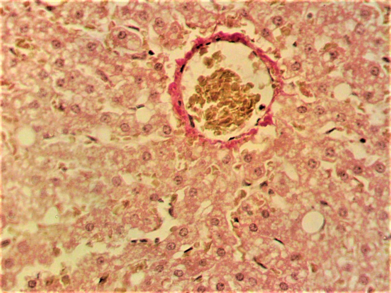 Гистологическая картина печени норки с индуцированным токсическим гепатитом