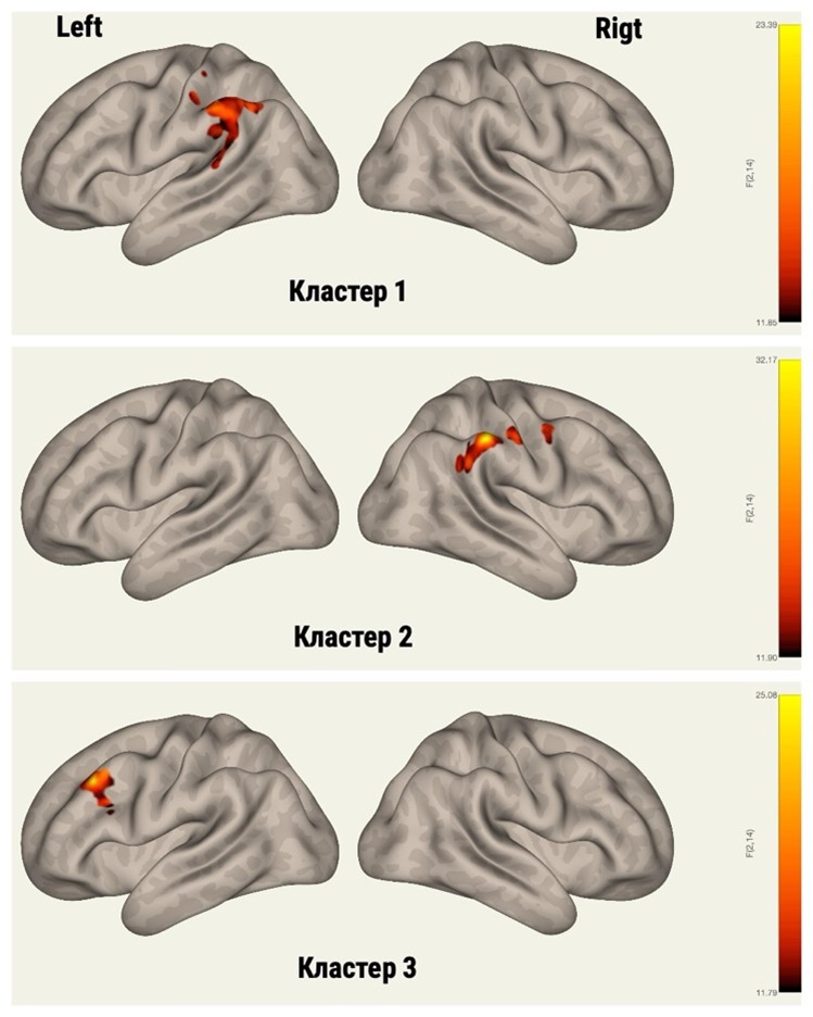 Кластеры головного мозга входящие в состав визуальной сети покоя ()