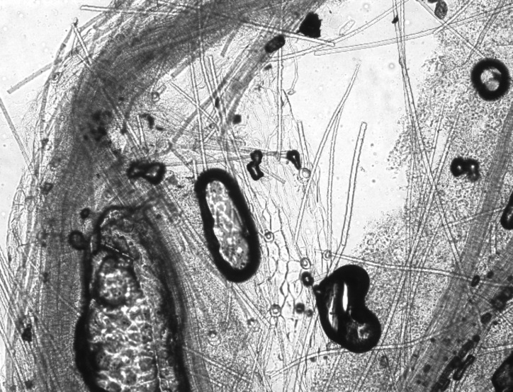 Кутикулярная структура эпидермиса листа эталонного препарата клевера пашенного (Trifolium arvense L.)