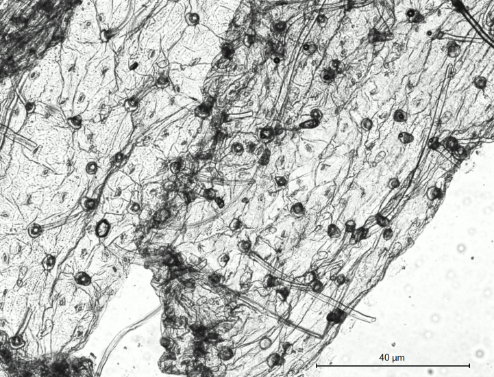 Кутикулярная структура эпидермиса листа эталонного препарата горошка мышиного (Vicia cracca L.)