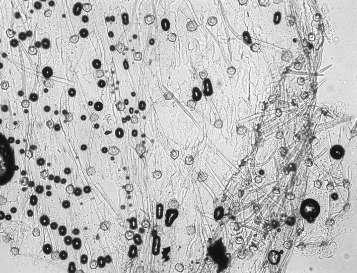 Кутикулярная структура эпидермиса листа эталонного препарата чины луговой(Lathyrus pratensis (L.) Doll)