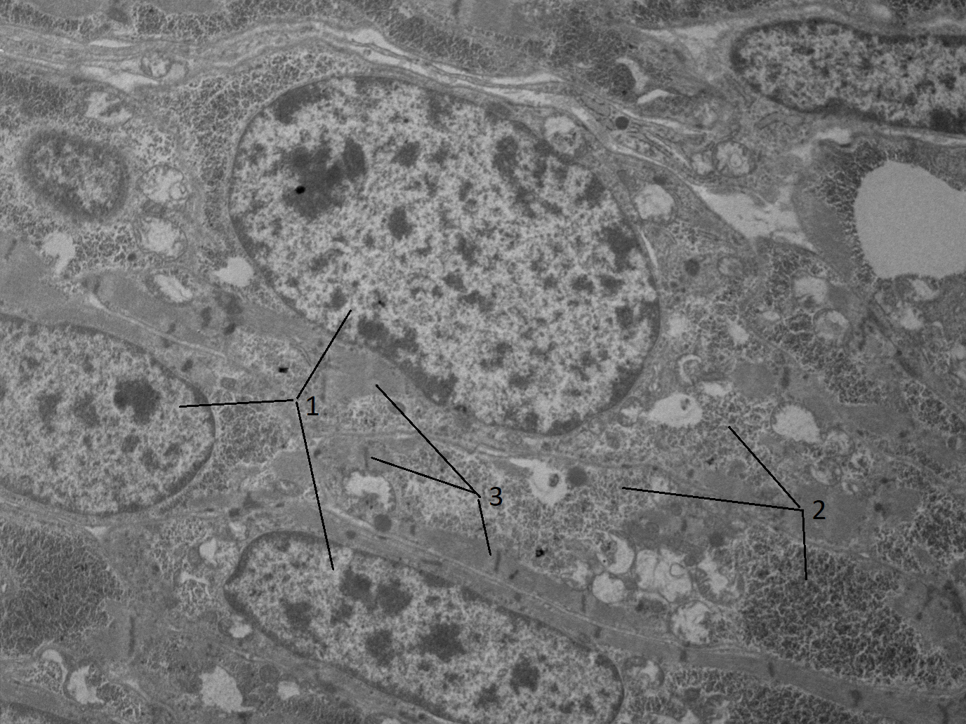 Продолжающие процессы цито дифференцировки в кардиомиоцитах куриного эмбриона:1 - активный деспирализованный хроматин; 2 - группы полисом; 3 - формирующиеся миофибриллы
