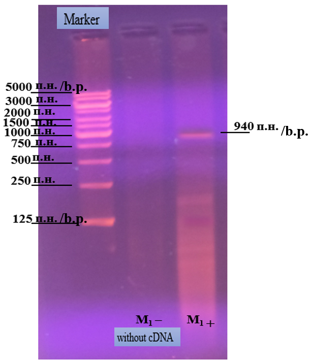 Electrophoresis result of PCR - thyroglobulin cDNA with primer M1