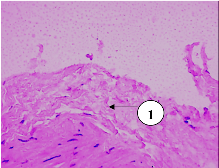 Мочевой пузырь кошки контрольной группы:1 – очаговая гиперплазия слизистой оболочки