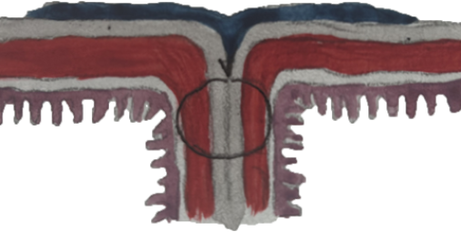 Схема нанесения клеевой композиции «Сульфакрилат» в зоне однорядного кишечного шва