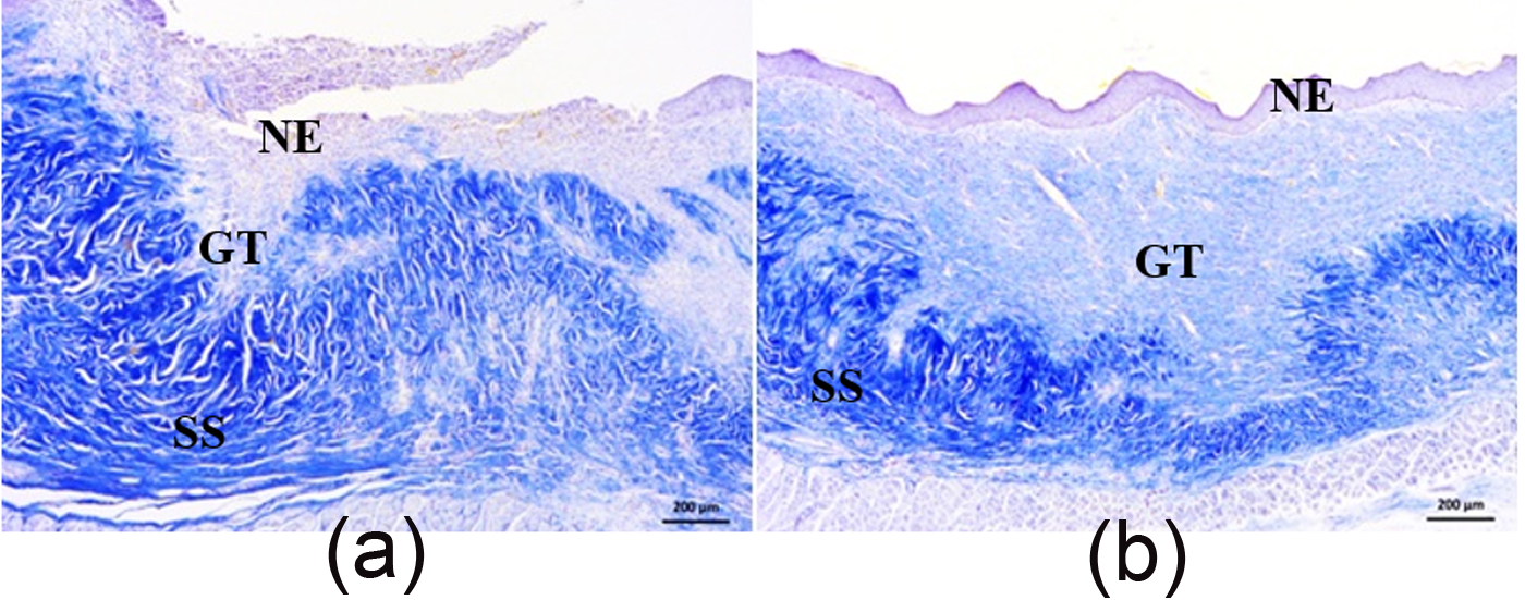 Cross sections of the central region of burn wounds of the skin of rats of the control (left) and experimental (on right) groups on the 30th day of healing. Staining with the modified azan method
