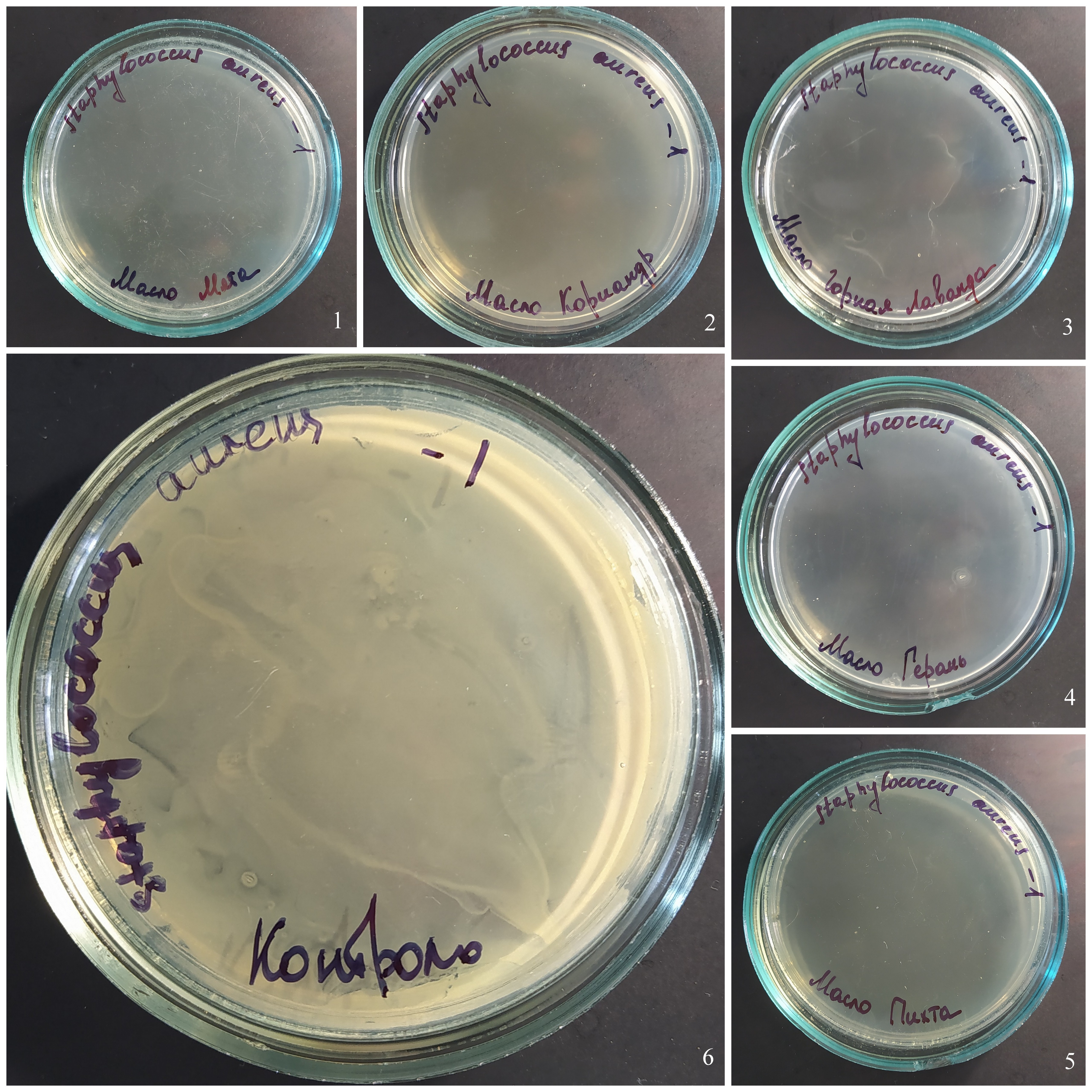 Действие паров эфирных масел на рост Staphylococcus aureus (разведение 10-1)