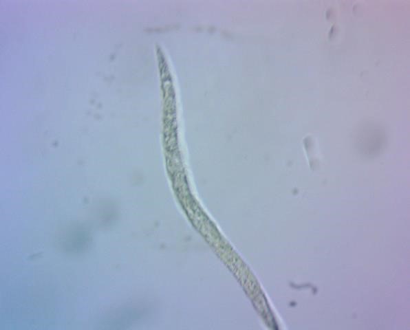 Личинка Strongyloides stercoralis, обнаруженная в смывах с капусты 