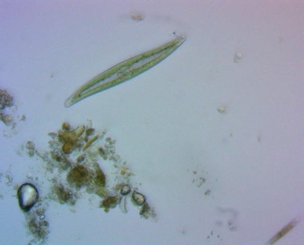 Условно-патогенные микроорганизмы, выявленные при исследовании образцов почвы