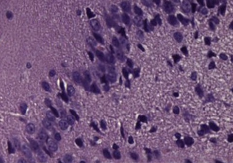 Пример микрофотографии гиппокампа, группа 3, X 400, окр. гематоксилин+эозин