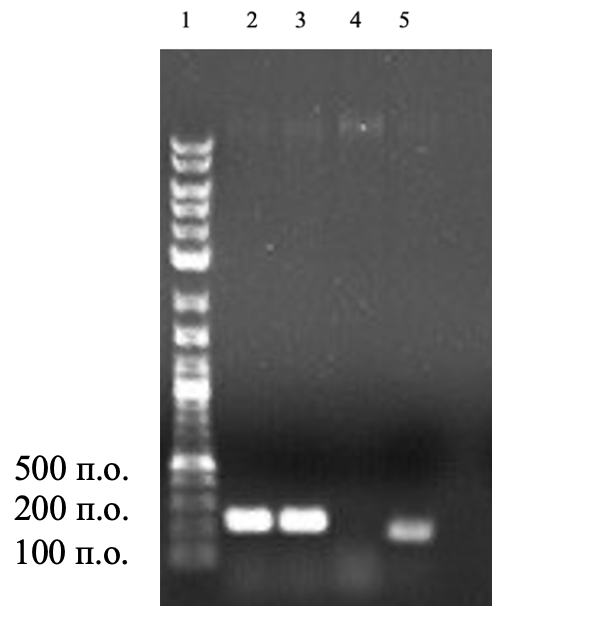 Электрофореграмма продуктов амплификации гена пероксидазы (per) и глутатионпероксидазы (gluper) P. chlororaphis subsp. aurantiaca