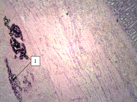  Микропрепарат фрагмента тонкого отдела кишки кошки. Очаги остеогенеза, стрелка 1. Окраска гематоксилином и эозином