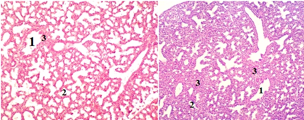 Срез легких плодов крыс в возрасте 23 суток гестации. Закладки лёгких с бронхами среднего (1) и малогокалибра (2) и окружающая эмбриональная соединительная ткань (3). Окраска гематоксилином и эозином