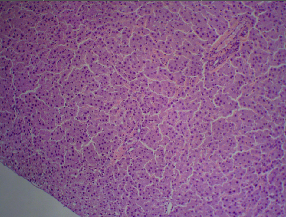 Hepatic lipidosis in an experimental rat