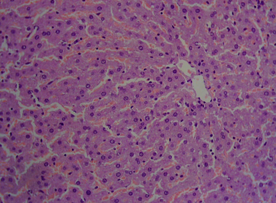 Hepatic lipidosis in an experimental rat