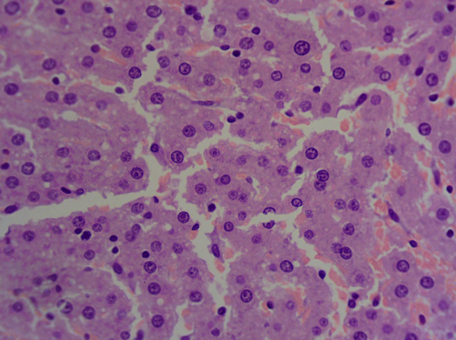 Hepatic lipidosis in an experimental rat