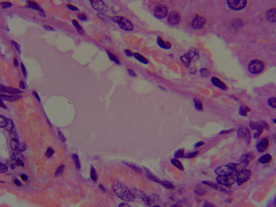 Hepatic lipidosis in an experimental rat