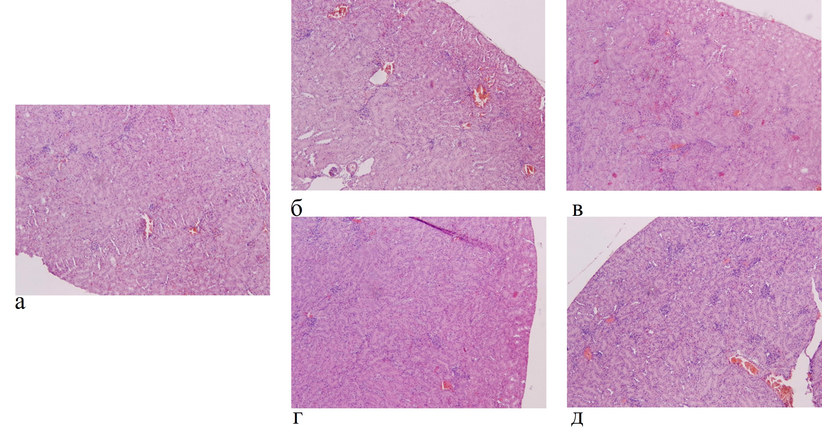 Микрофотография почки: а - контрольная группа; б - группа, получавшая экстракт на протяжении 7 дней в дозе 10 мг/мл; в - группа, получавшая экстракт на протяжении 7 дней в дозе 100 мг/мл; г - группа, получавшая экстракт на протяжении 14 дней в дозе 10 мг/мл; д - группа, получавшая экстракт на протяжении 14 дней в дозе 100 мг/мл