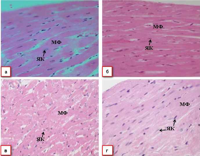 Микрофотография, продольный срез сердечной ткани в исследуемых подгруппах:(а) подгруппа 1А, которой вводили физиологический раствор натрия хлорида; (б) подгруппа 1Б, которой вводили 0,125 г/кг экстракта AN; (в) подгруппа 2А, аллоксан-индуцированный диабет+физиологический раствор натрия хлорида; (г) подгруппа 2Б, аллоксан-индуцированный диабет+ 0,125 г/кг экстракта AN