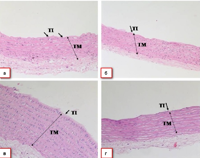 Микрофотография, показывающая участок ткани аорты в исследуемых подгруппах:(а) подгруппа 1А, которой вводили физиологический раствор натрия хлорида; (б) подгруппа 1Б, которой вводили 0,125 г/кг экстракта AN; (в) подгруппа 2А, аллоксан-индуцированный диабет+физиологический раствор натрия хлорида; (г) подгруппа 2Б, аллоксан-индуцированный диабет+ 0,125 г/кг экстракта AN