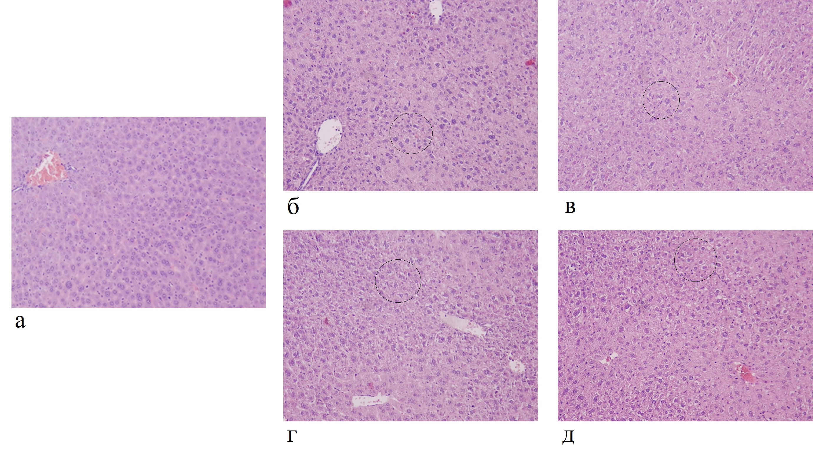Микрофотография печени: а - контрольная группа; б - группа, получавшая экстракт на протяжении 7 дней в дозе 10 мг/мл; в - группа, получавшая экстракт на протяжении 7 дней в дозе 100 мг/мл; г - группа, получавшая экстракт на протяжении 14 дней в дозе 10 мг/мл; д - группа, получавшая экстракт на протяжении 14 дней в дозе 100 мг/мл