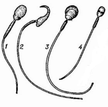 Сперматозоиды млекопитающих: 1 – кролика; 2 – крысы; 3 – морской свинки; 4 – человека