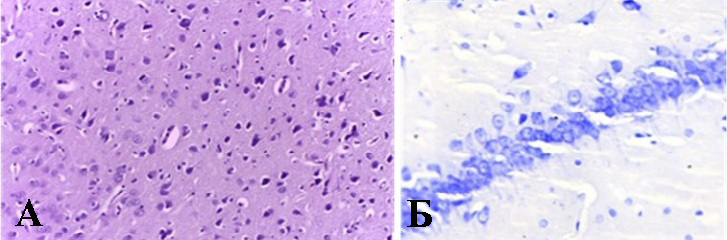 Пример гистологического препарата головного мозга крысы из группы №2: А - лобная доля, окраска гематоксилин+эозин, X 400; Б – СА1 область гиппокампа, окраска тионином по Нисслю, X 400