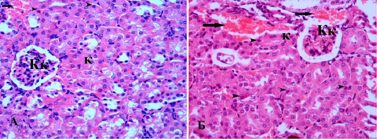 Препарат почки крысы: А - из группы 6, получавшей AN в дозе 0,25 г/кг; Б - из группы 7, получавшей глибенкламид в дозе 25 мг/кг 