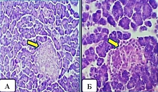 Пример срезов ткани поджелудочной железы у животных в группе 3 на 21-е сутки от начала эксперимента