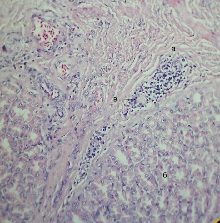 Железистый отдел желудка утки кросса Агидель, подслизистая основаа – лимфоидный узелок, б – долька глубокой железы, в – лимфатический сосуд 