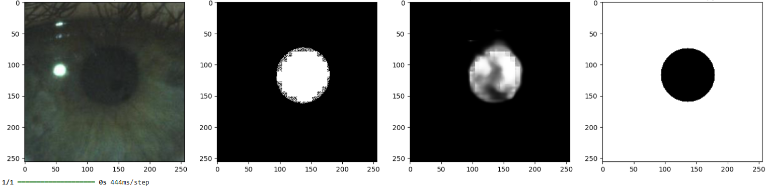 Пример предсказания модели PupillAI