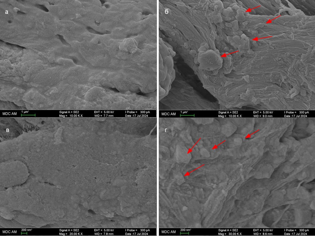 Сканирующая электронная микроскопия поверхности мениска: а, в – поверхность мениска без внутрисуставного введения МВ; б, г – поверхность мениска после внутрисуставного введения МВ