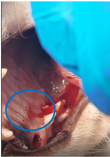  Место кровотечения из повреждения, расположенного на верхнем нёбе (Язва Менрата)