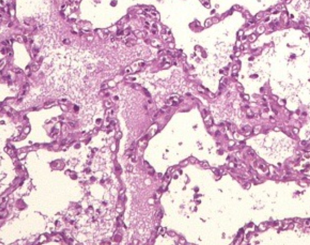 Изображение до фильтрации