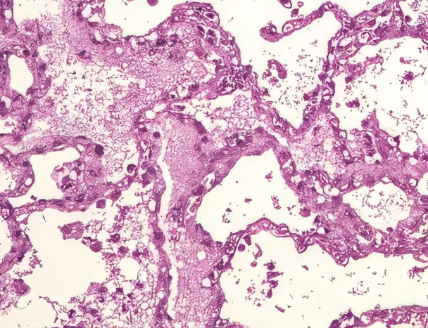 Изображение после фильтрации