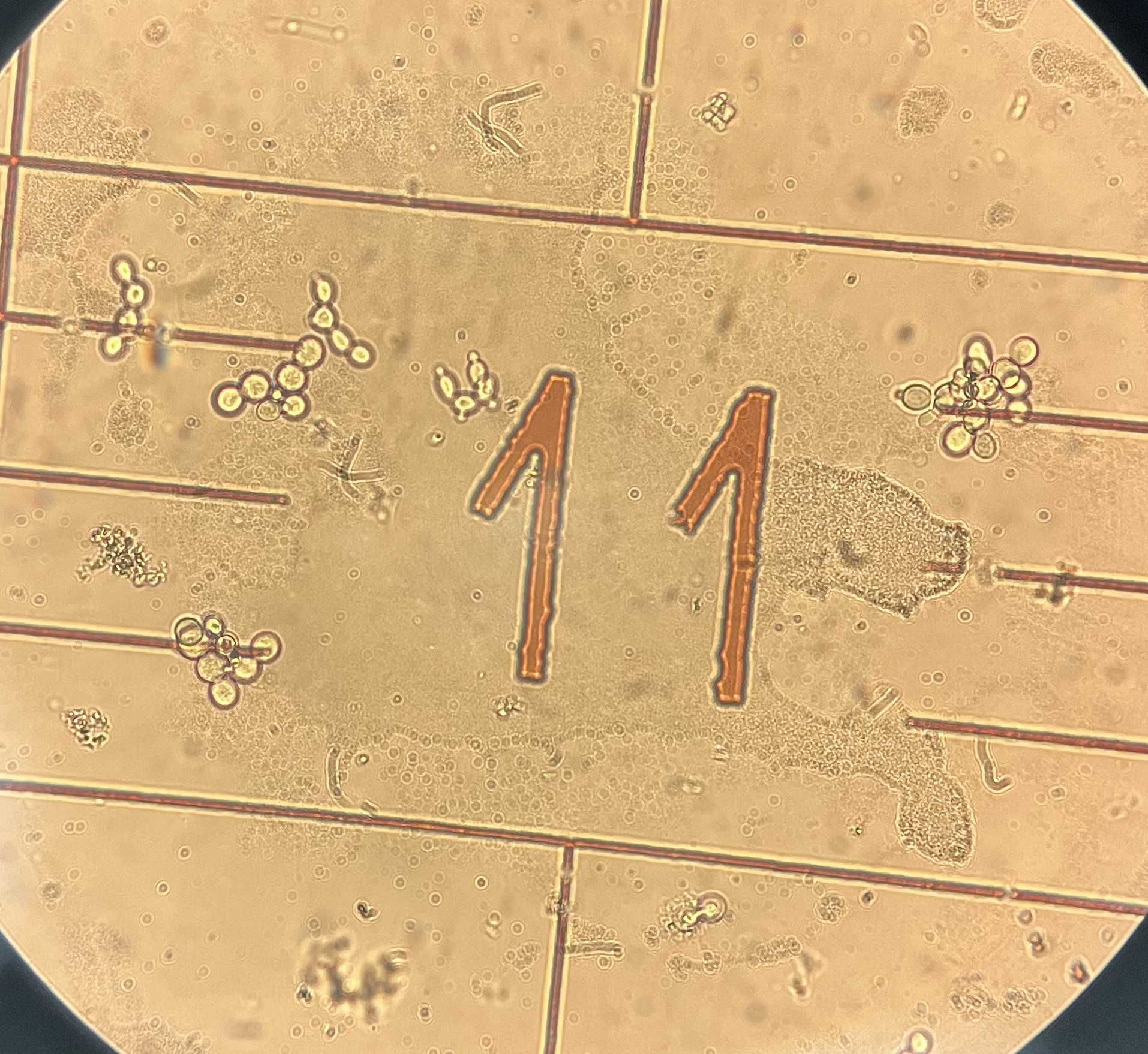 «Цепное» почкование дрожжевых клеток под действием метилурацила