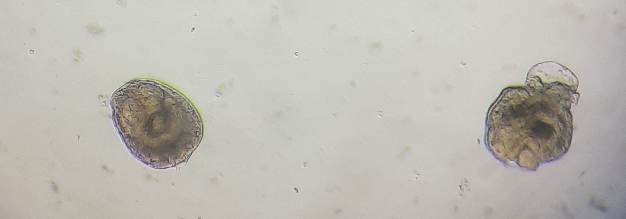 Протосколексы эхинококкового пузыря почки