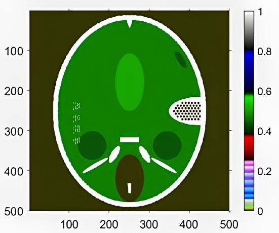 Результаты реконструкции цифрового фантома Форбильда