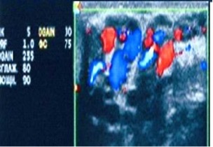 Доплеровское исследование: основная группа