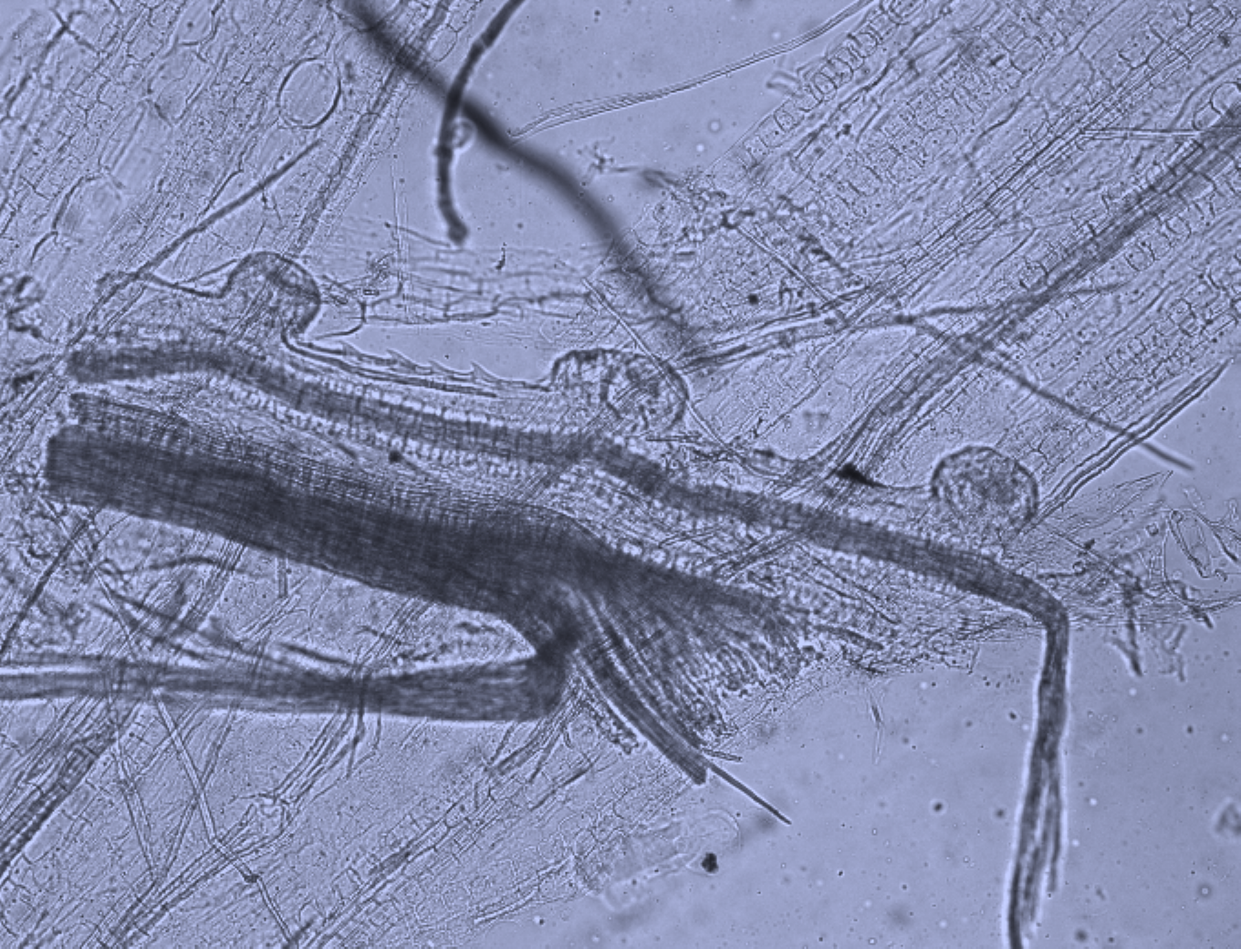 Бородавчатые железки кутикулы эпидермиса плода