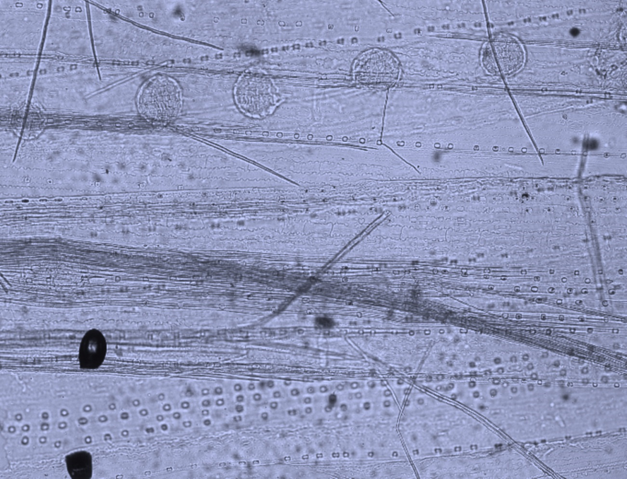 Бородавчатые железки кутикулы эпидермиса стебля