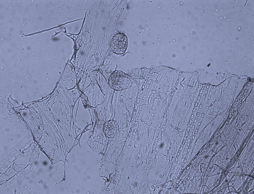 Бородавчатые железки кутикулы эпидермиса листа