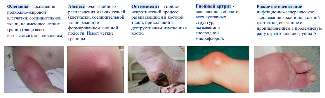 Профилактика, диагностика и лечение пролежневого процесса у пациентов, нуждающихся в паллиативной помощи. Практическое руководство для врачей и медицинских сестер