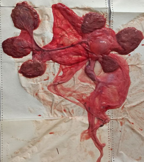 Олигокотиледонная анатомическая структура плаценты важенок северного домашнего оленя после отделения