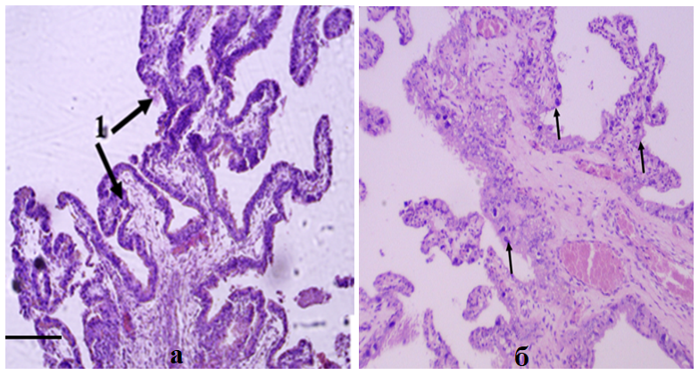 Морфология фрагмента ворсинки хориона