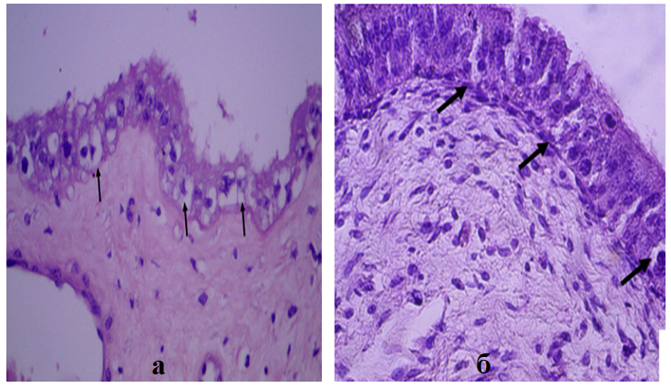 Фетальная часть плаценты северного домашнего оленя на последних сроках гестации (эпителий амниона с частичным разрушением и перинуклеарной вакуолизацией, стрелки)