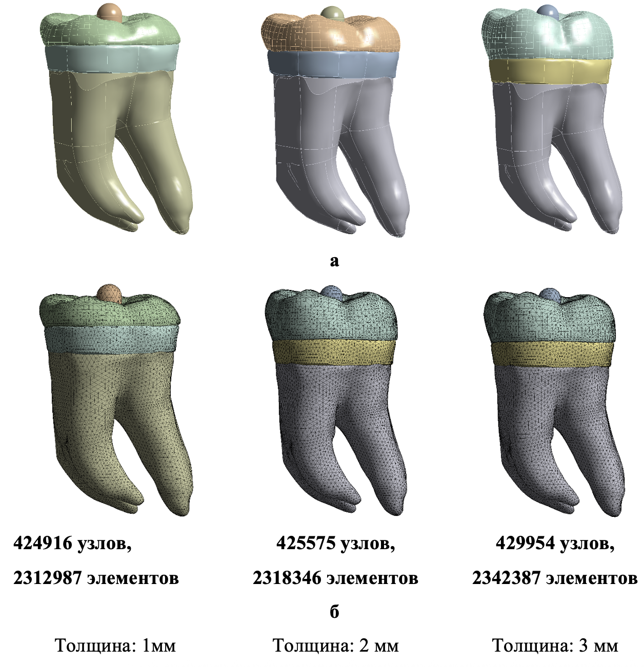 Твердотельная модель с сеткой конечных элементов: а - твердотельная модель зуба с эндокоронкой; б - конечно-элементная сетка зуба с эндокоронкой