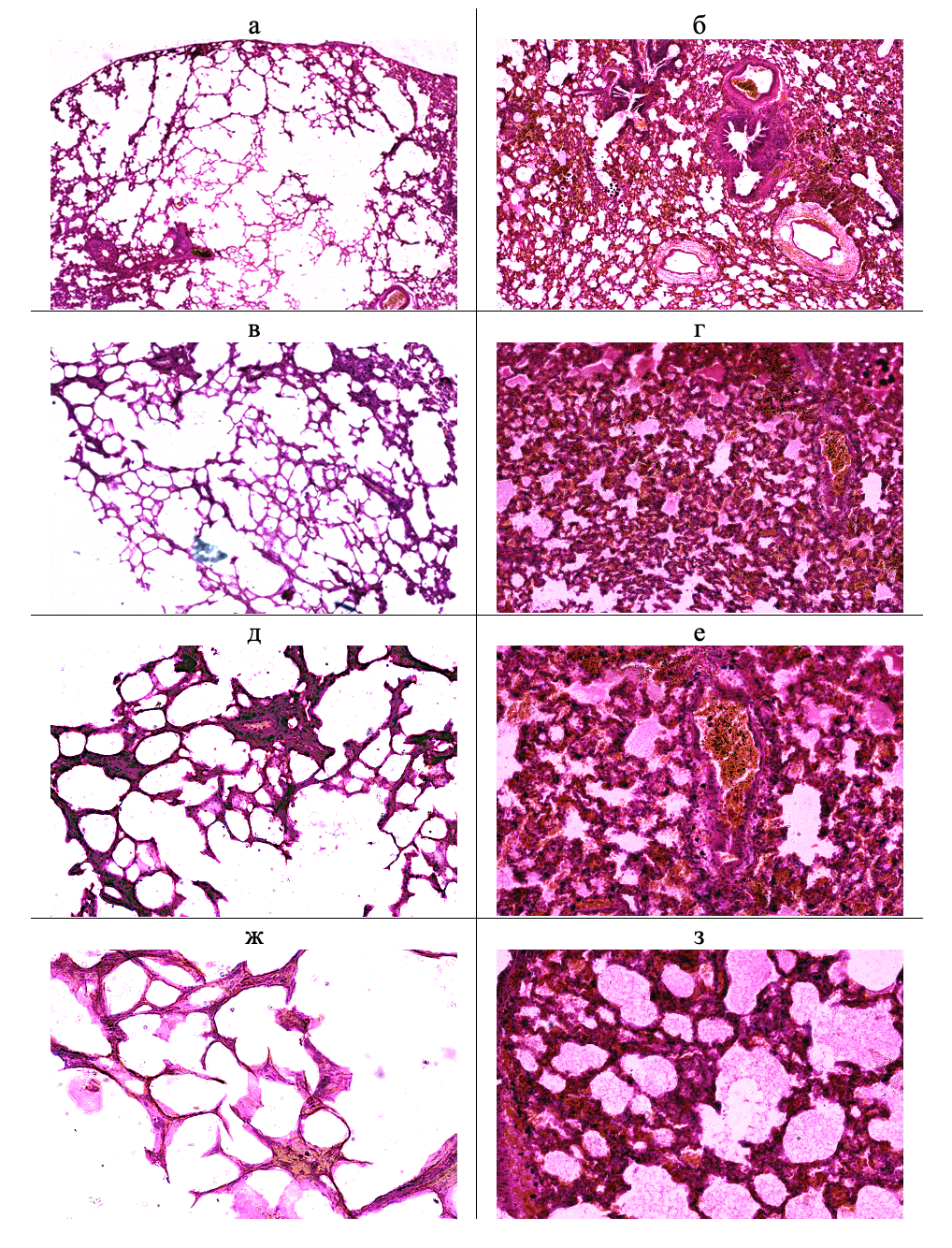 Паренхима легких на парафиновых срезах у животных контрольной (а, в, д, ж) и опытной (б, г, е, з) групп