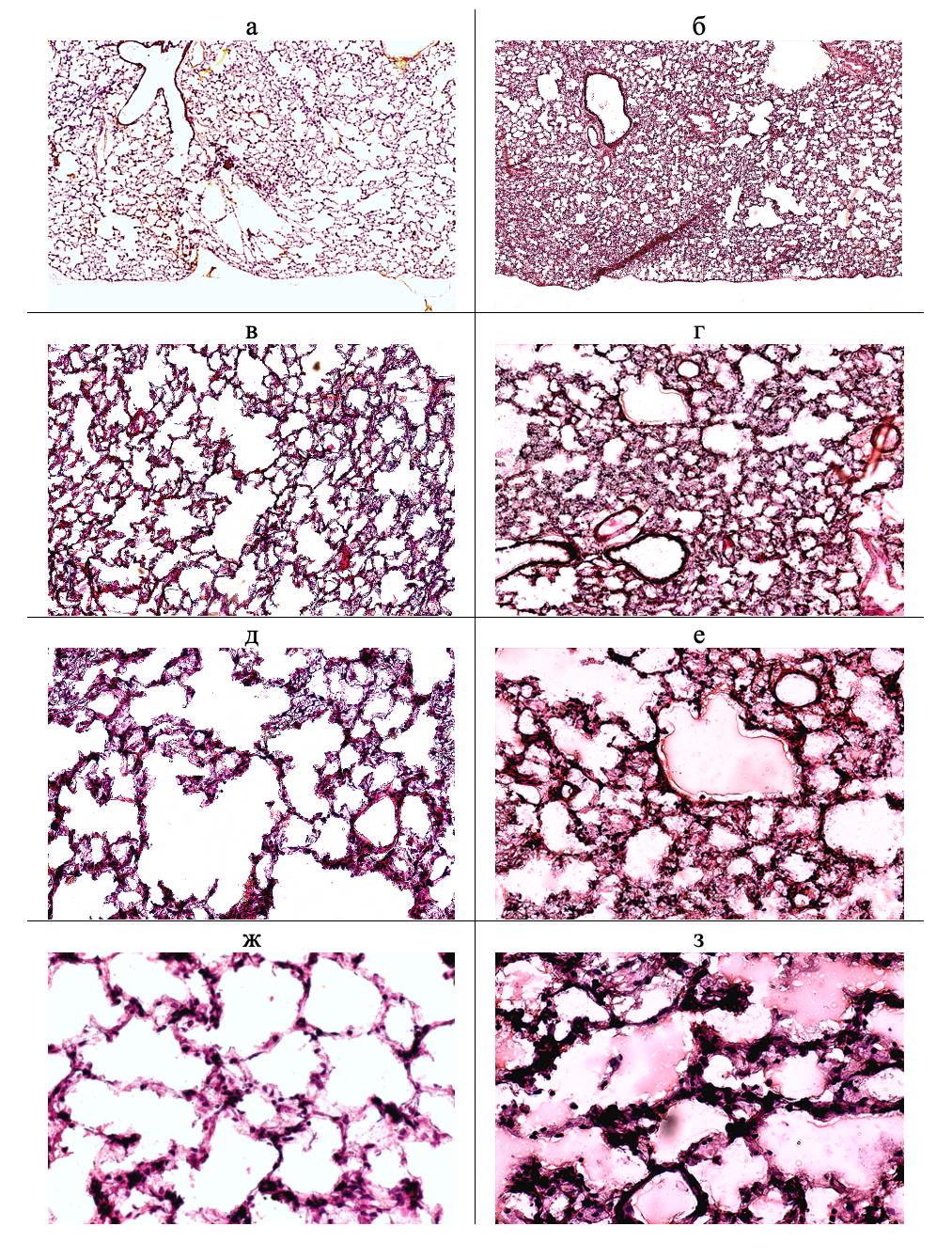 Паренхима легких на криостатных срезах у животных контрольной (а, в, д, ж) и опытной (б, г, е, з) групп