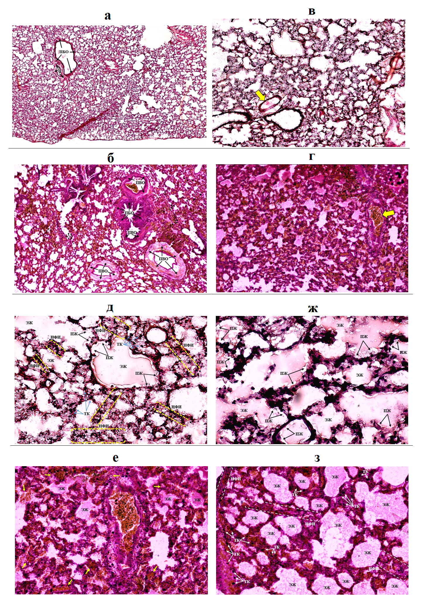 Паренхима легких на криостатных (а, в, д, ж) и парафиновых (б, г, е, з) срезах у животных опытных групп
